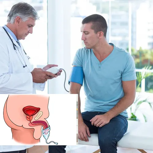Why Choose Florida Urology Partners

 for Penile Implant Surgery?