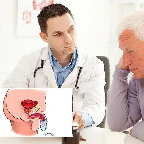 Florida Urology Partners

is Here to Guide You Through Your Decision