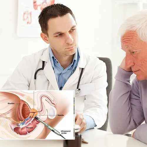 The Types of Penile Implants Available